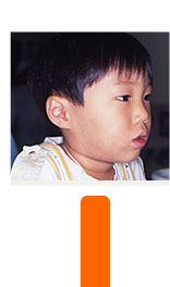 症例２ 初診時 ３歳８ヵ月