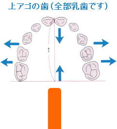 症例２ 初診時 ３歳８ヵ月