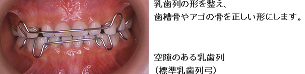 症例３ ５歳９ヵ月