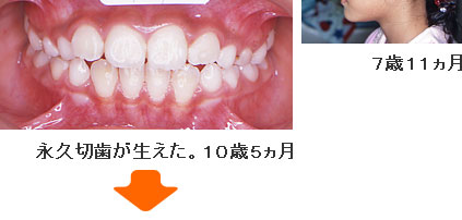 症例５ １０歳５ヵ月