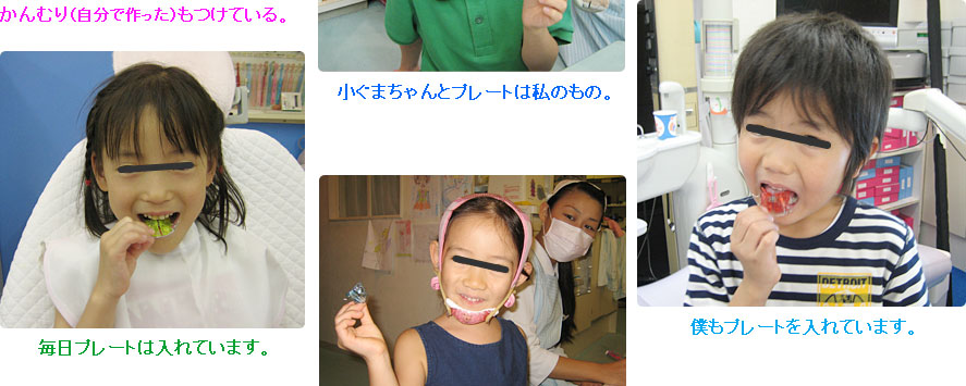 子供の矯正