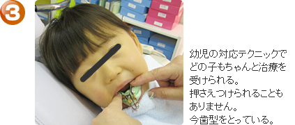 乳歯の歯並び矯正、ステップ３－矯正治療も受けられるようになった